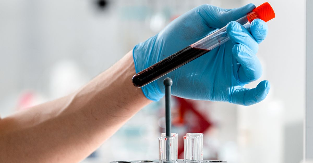 Bilan de coagulation : TP, TCA et risque hémorragique avant une chirurgie - Laboratoire Le Clair de la Plume Douala