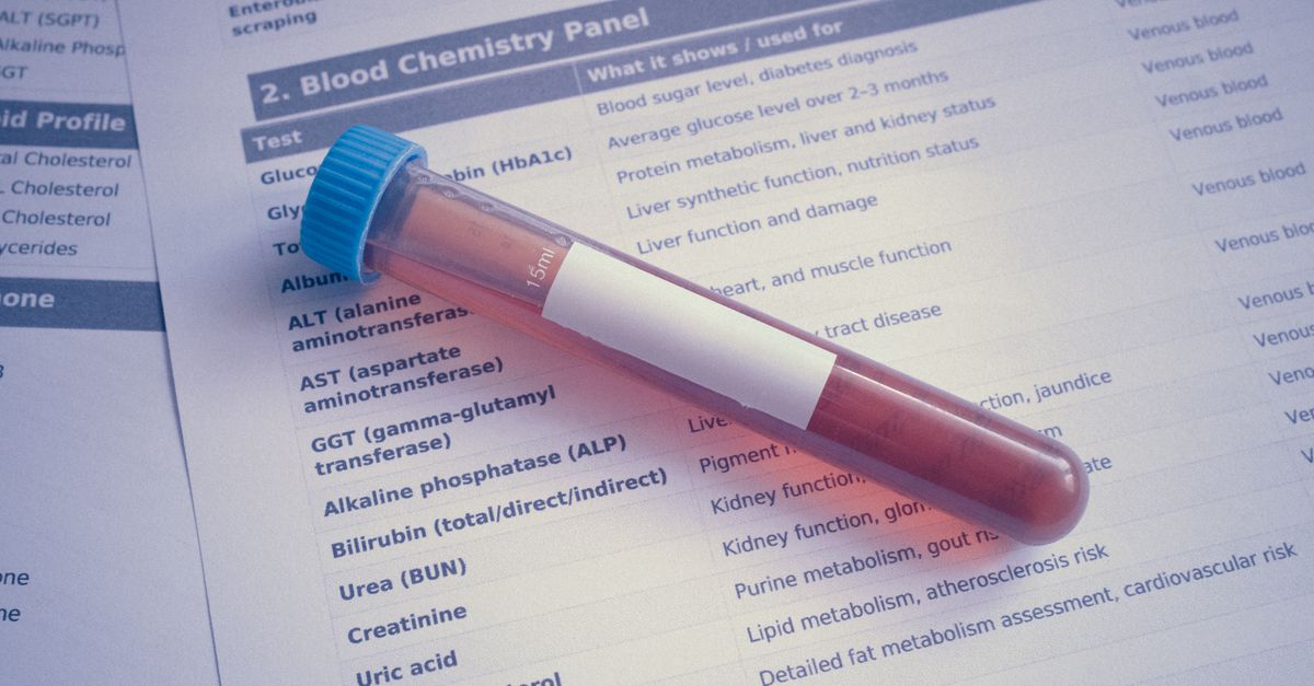 Bilan hépatique complet : transaminases, bilirubine et gamma GT expliqués - Laboratoire Le Clair de la Plume Douala
