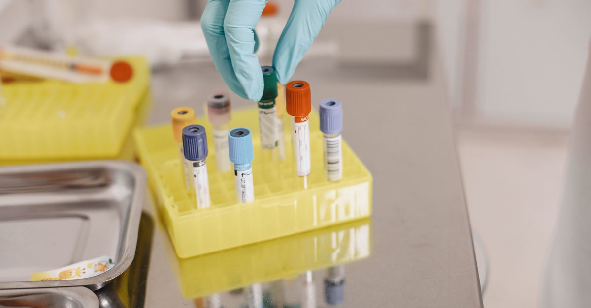 Échographie de la prostate : dépistage et suivi chez l'homme après 50 ans - Laboratoire Le Clair de la Plume Douala